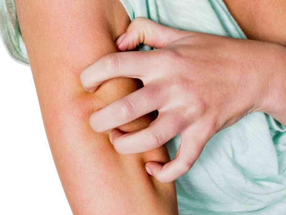 Immagine articolo: La psoriasi tra conseguenze psicologiche e possibili cure. Ecco cosa sapere