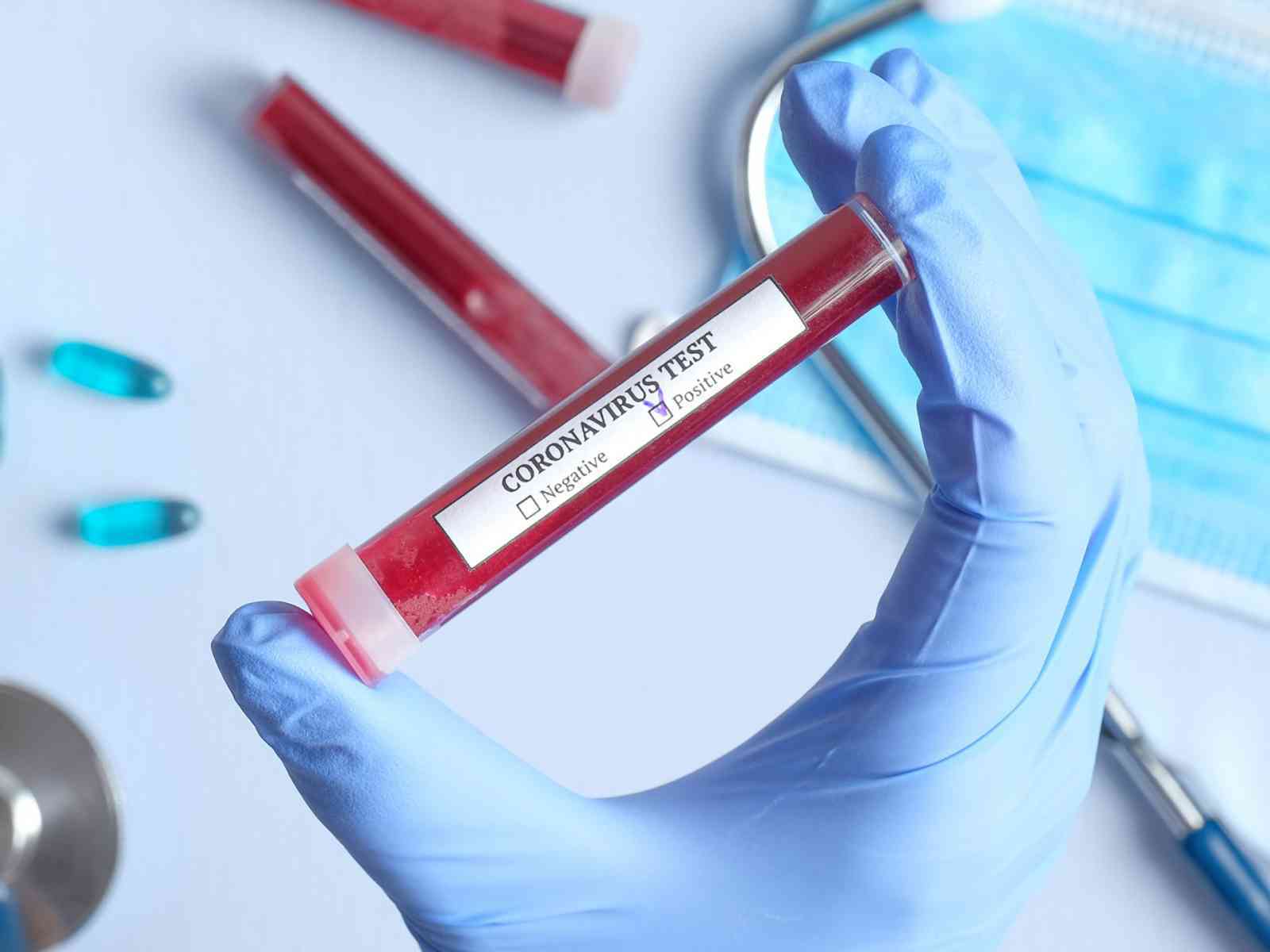 Immagine articolo: Coronavirus in Sicilia, reso noto il bollettino odierno. 95 le persone ricoverate e 108 in isolamento domiciliare